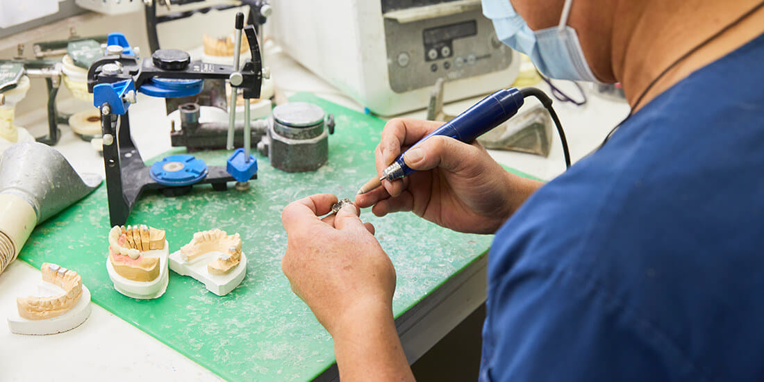 義歯製作